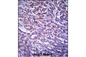 XIRP1 Antibody (C-term) (ABIN657535 and ABIN2846553) immunohistochemistry analysis in formalin fixed and paraffin embedded human heart tissue followed by peroxidase conjugation of the secondary antibody and DAB staining. (XIRP1 antibody  (C-Term))