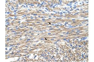 MBNL1 antibody was used for immunohistochemistry at a concentration of 4-8 ug/ml to stain Myocardial cells (arrows) in Human Liver. (MBNL1 antibody)