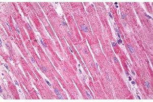 ABIN571179 (5µg/ml) staining of paraffin embedded Human Heart. (Dystroglycan antibody  (Internal Region))
