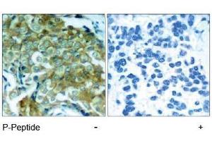 Image no. 1 for anti-Epidermal Growth Factor Receptor (EGFR) (pTyr1172) antibody (ABIN196961) (EGFR antibody  (pTyr1172))