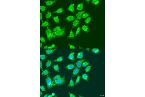 Immunofluorescence analysis of U2OS cells using MCCC2 antibody  at dilution of 1:100. (MCCC2 antibody  (AA 284-563))