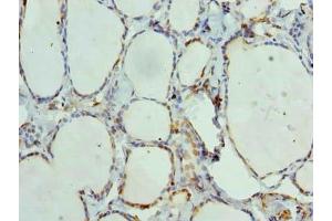 Immunohistochemistry of paraffin-embedded human thyroid tissue using ABIN7144163 at dilution of 1:100 (ANKMY1 antibody  (AA 1-220))