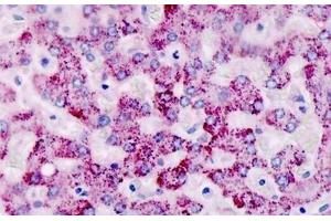 Human, Liver: Formalin-Fixed Paraffin-Embedded (FFPE) (CAPNS2 antibody  (AA 55-83))