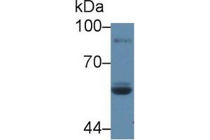 Western blot analysis of Human Saliva, using Rat LPO Antibody (5 µg/ml) and HRP-conjugated Goat Anti-Rabbit antibody ( (LPO antibody  (AA 351-589))