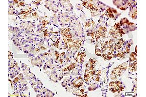 Immunohistochemistry (IHC) image for anti-2',3'-Cyclic Nucleotide 3' phosphodiesterase (CNP) (AA 151-250) antibody (ABIN730738) (Cnpase antibody  (AA 151-250))