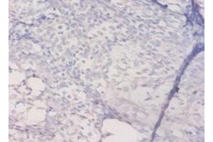 Immunohistochemistry of paraffin-embedded human prostate tissue using ABIN7155589 at dilution of 1:50 (HLA-DQA1 antibody  (AA 24-213))