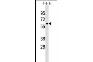 ZN Antibody (C-term) (ABIN1882025 and ABIN2838410) western blot analysis in Hela cell line lysates (35 μg/lane). (ZNF410 antibody  (C-Term))