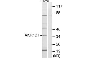 Western blot analysis of extracts from HUVEC cells, using AKR1B1 antibody. (AKR1B1 antibody)