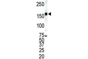 Western blot analysis of ERBB4 antibody and T47D cell lysate. (ERBB4 antibody  (AA 1276-1308))