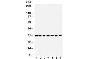 Western blot testing of 1) rat brain, 2) rat liver, 3) rat kidney, 4) mouse brain, 5) Jurkat, 6) CEM and 7) HeLa lysate with COMT antibody. (COMT antibody  (AA 52-271))
