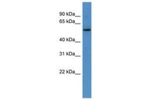 Image no. 1 for anti-PAP Associated Domain Containing 4 (PAPD4) (C-Term) antibody (ABIN6746298) (PAPD4 antibody  (C-Term))