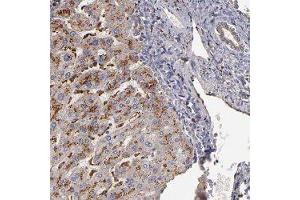 Immunohistochemical staining of human liver with TRAF1 polyclonal antibody  shows strong granular cytoplasmic positivity in hepatocytes.
