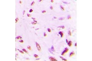 Immunohistochemistry (IHC) image for anti-Tumor Protein P53 (TP53) (acLys381), (C-Term) antibody (ABIN7301402)