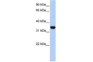 LDHA antibody used at 1 ug/ml to detect target protein.