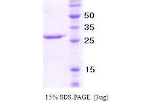 Figure annotation denotes ug of protein loaded and % gel used. (NCR/Nkp46 Protein)