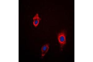 Immunofluorescent analysis of Cytochrome P450 3A4/5 staining in HepG2 cells. (Cytochrome P450 3A4, 3A5 (Center) antibody)
