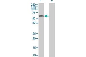 Western Blot analysis of CES1 expression in transfected 293T cell line by CES1 MaxPab polyclonal antibody. (CES1 antibody  (AA 1-566))