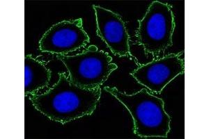 Immunofluorescent analysis of U251 cells using KIT antibody. (KIT antibody)