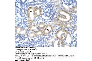 Human kidney (T-Box 1 antibody  (C-Term))