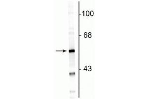 Western blot of rat cortical lysate showing specific immunolabeling of the ~50 kDa GFAP protein. (GFAP antibody)