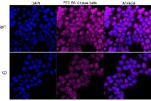 Immunocytochemical staining of HeLa cells using P70 S6 Kinase beta antibody (ABIN7800226), 1:1,000), Top panel: wild-type (WT), Bottom panal: P70 S6 Kinase beta shRNA knockdown (KD).