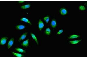 Immunofluorescent analysis of Hela cells using ABIN7153133 at dilution of 1:100 and Alexa Fluor 488-congugated AffiniPure Goat Anti-Rabbit IgG(H+L) (FHL2 antibody  (AA 112-233))