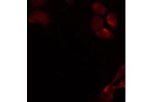 ABIN6274905 staining Hela by IF/ICC. (B3GALT4 antibody  (Internal Region))