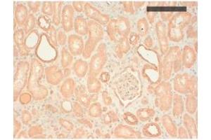 Image no. 1 for anti-Keratin Basic antibody (ABIN341107) (Keratin Basic antibody)