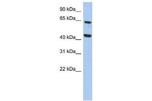 EFHA2 antibody used at 1 ug/ml to detect target protein. (EFHA2 antibody  (N-Term))