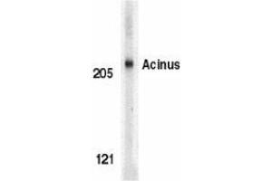 Western blot analysis of Acinus in K562 whole cell lysate with AP30012PU-N Acinus antibody (IN) at 1 μg/ml. (ACIN1 antibody  (Intermediate Domain))