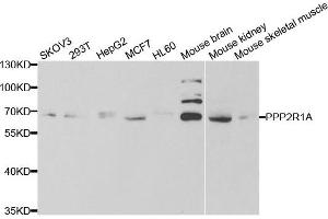 Western blot analysis of extracts of various cell lines, using PPP2R1A antibody. (PPP2R1A antibody)