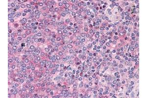 Immunohistochemistry (IHC) image for anti-ADAM Metallopeptidase Domain 17 (ADAM17) (AA 215-315) antibody (ABIN614668) (ADAM17 antibody  (AA 215-315))