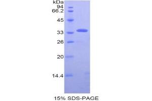 SDS-PAGE (SDS) image for Pyruvate Dehydrogenase beta (PDHB) (AA 31-341) protein (His tag) (ABIN1525570)