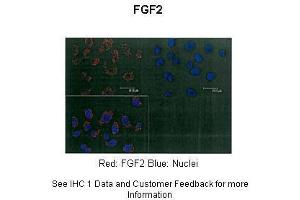 Immunohistochemistry (IHC) image for anti-Fibroblast Growth Factor 2 (Basic) (FGF2) (Middle Region) antibody (ABIN2777106)