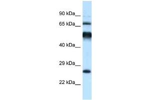 WB Suggested Anti-Klhl1 Antibody Titration: 1. (KLHL1 antibody  (C-Term))