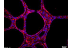 Tissue/cell: human thyroid gland, 4% Paraformaldehyde-fixed and paraffin-embeddedAntigen retrieval: citrate buffer (0. (GFRA4 antibody  (AA 51-150))