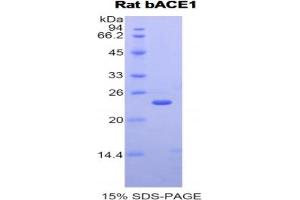 SDS-PAGE analysis of Rat bACE1 Protein. (BACE1 Protein)
