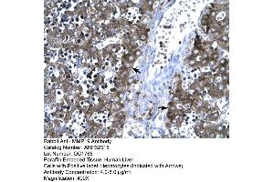 Human Liver (MMP19 antibody  (C-Term))