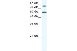 WB Suggested Anti-FLJ23436 Antibody Titration:  1. (ZNF768 antibody  (N-Term))