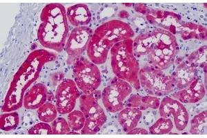 Human Kidney: Formalin-Fixed Paraffin-Embedded (FFPE) (Glycerol Kinase antibody  (AA 461-510))