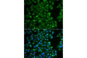 Immunofluorescence analysis of A549 cell using ANXA11 antibody. (Annexin A11 antibody)