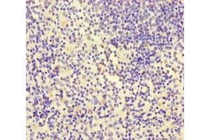 Immunohistochemistry of paraffin-embedded human spleen tissue using ABIN7156438 at dilution of 1:100 (ITGA4 antibody  (AA 376-558))