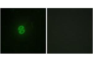 Immunofluorescence analysis of A549 cells, using CD253 Antibody. (TRAIL antibody  (AA 31-80))