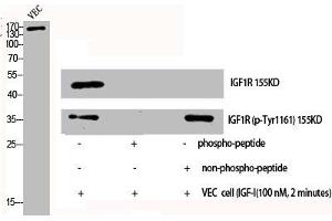 Western Blot analysis of VEC cells using Phospho-IGF-IR (Y1161) Polyclonal Antibody (IGF1R antibody  (pTyr1161))
