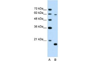 WB Suggested Anti-SLC38A4 Antibody Titration:  2.