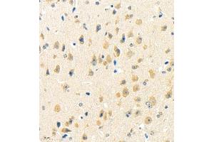 Immunohistochemistry of paraffin embedded mouse brain using rasgrf1 (ABIN7073422) at dilution of 1:4000 (400x lens) (Cdc25 antibody)