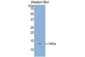 Detection of Recombinant DKK2, Human using Polyclonal Antibody to Dickkopf Related Protein 2 (DKK2) (DKK2 antibody  (AA 159-258))