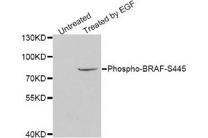Western blot analysis of extracts of HeLa cell line, using Phospho-BRAF-S445 antibody. (BRAF antibody  (pSer445))