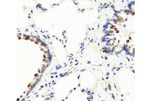 Immunohistochemistry of paraffin-embedded Rat lung using NTF3 Polyclonal Antibody at dilution of 1:100 (40x lens). (Neurotrophin 3 antibody)