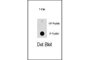 Dot blot analysis of anti-Phospho-MEK1 Pab (ABIN389590 and ABIN2839607) on nitrocellulose membrane. (MEK1 antibody  (pSer218, pSer222))